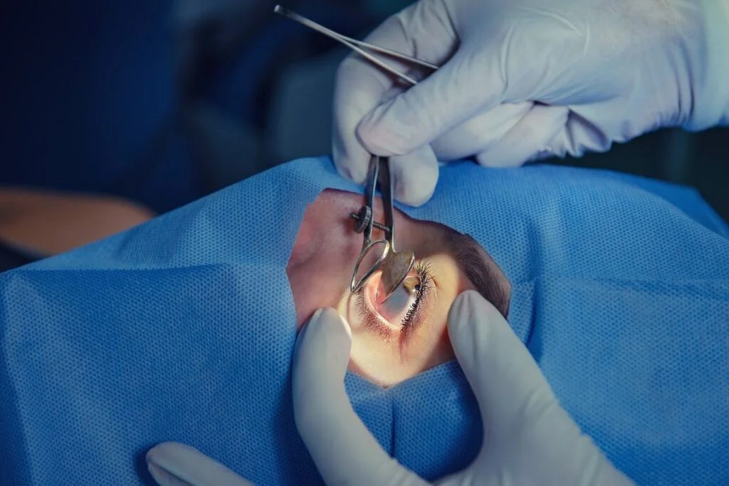 Oculoplasty surgery